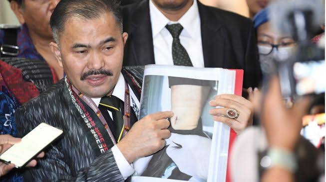 kuada hukum brigadir J