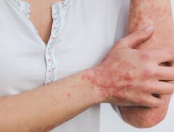 Ilustrasi penyakit kulit scabies. (Pixabay) Ilustrasi penyakit kulit scabies. (Pixabay)
