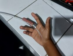 Jari tangan tersangkut di tutup botol the