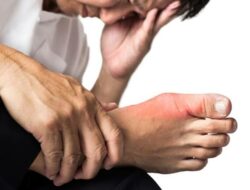 Gejala penyakit asam urat yang tak biasa (istimewa)