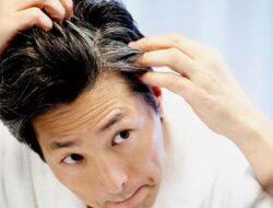 Rambut uban.(istimewa/indonesiadaily.net)