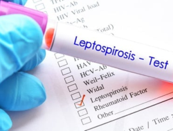 Penyakit leptospirosis saat musim hujan.(istimewa/indonesiadaily.net)